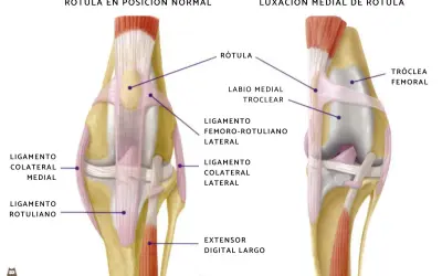 Anatomía comparada de la rodilla de un perro: rótula en posición normal vs. luxación medial de rótula, mostrando ligamentos y estructuras óseas.