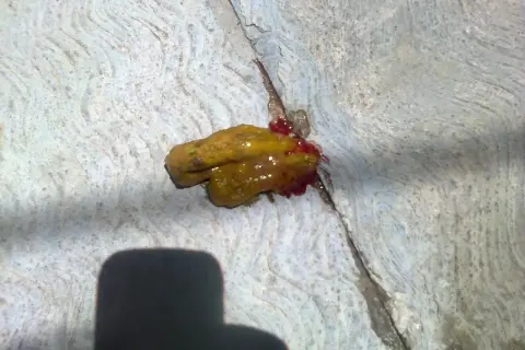Heces de perro con moco y sangre.