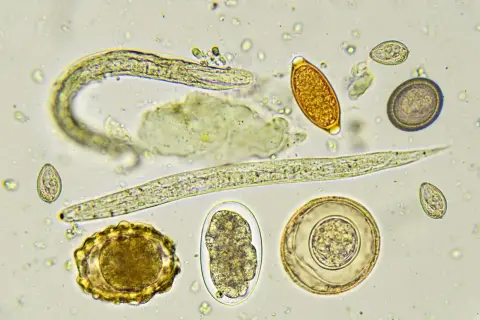 Microscopio muestra varios tipos de lombrices intestinales en perros, incluyendo huevos y larvas de parásitos.