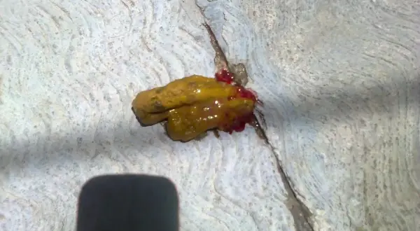 Heces de perro con moco y sangre.