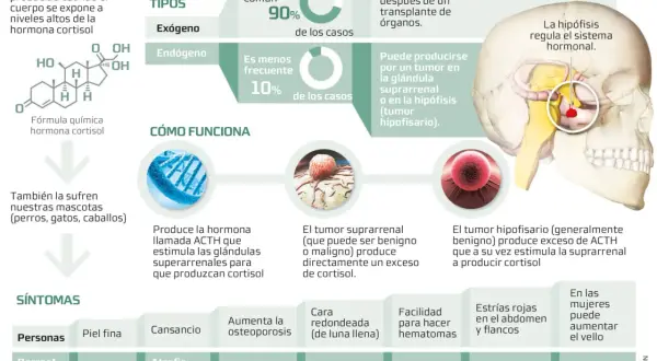 Infografía sobre el síndrome de Cushing, sus tipos, causas y síntomas en humanos y perros.