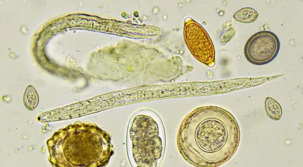 Microscopio muestra varios tipos de lombrices intestinales en perros, incluyendo huevos y larvas de parásitos.