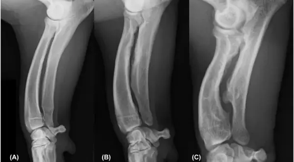 Radiografías de la deformación de patas delanteras de perros, mostrando la progresión de la condición en tres etapas (A, B, C).