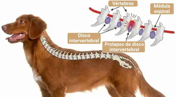 Ilustración de un perro con hernia discal, mostrando vértebras, disco intervertebral y médula espinal. El prolapso puede ser tan grave que se considere sacrificar perro por hernia discal.