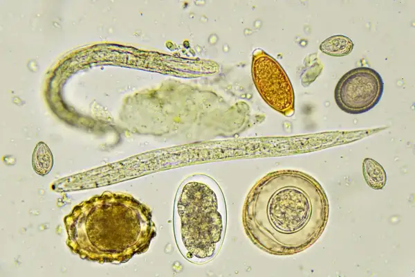Microscopio muestra varios tipos de lombrices intestinales en perros, incluyendo huevos y larvas de parásitos.